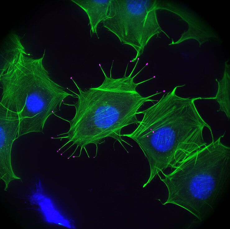 Fluoreszenzmikroskopie von Membran-Ausstülpungen einer Mauszelle. Das Aktin-Zellskelett ist grün, das Motorprotein Myosin X ist magenta und der Zellkern ist blau dargestellt.