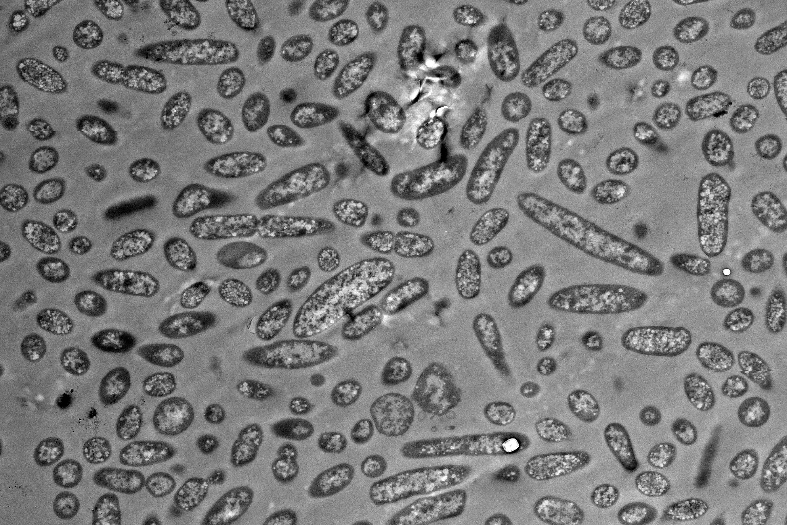 Elektronenmikroskopische Aufnahme von Bacteroides thetaiotaomicron, die die Unterschiede in der Größe der Bakterienzellen verdeutlicht.