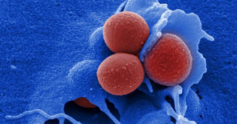 HZI | Staphylococcus aureus - Danger from the nose