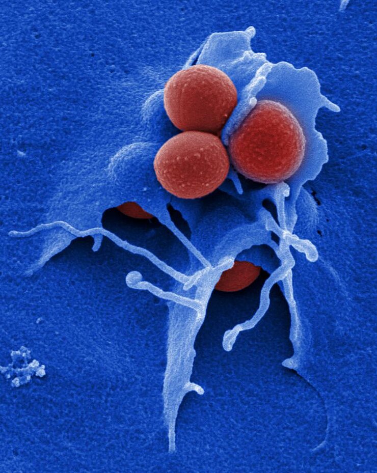  Staphylococcus aureus