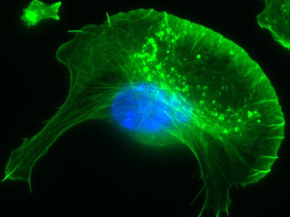 Actin fluorescence microscopic image (green)