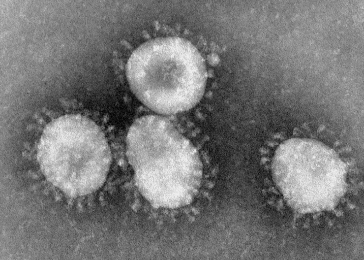 Electron microscope image of coronaviruses