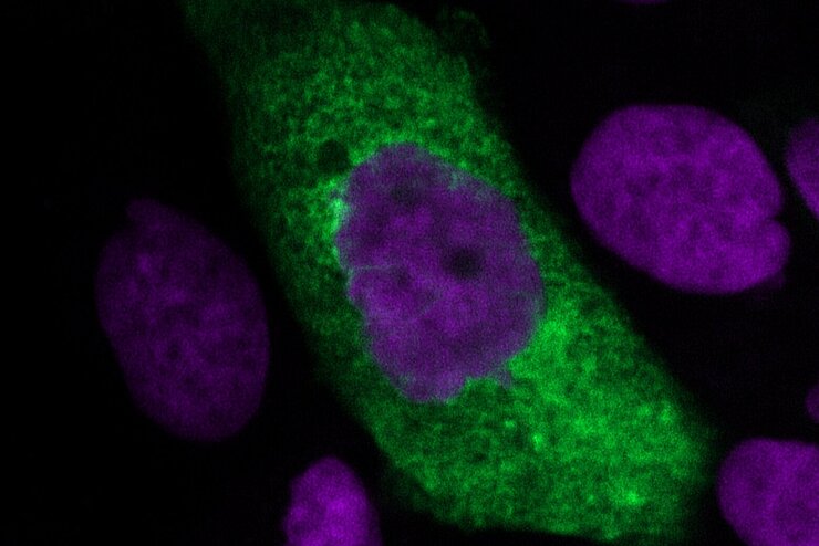 Neue Viruspartikel (in grün) einer mit SARS-CoV-2 infizierten Lungenzelle (Zellkerne in violett)