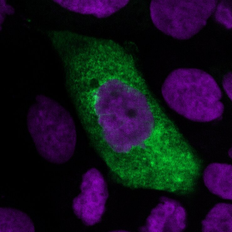 New virus particles (in green) of a lung cell infected with SARS-CoV-2 (cell nuclei in purple).