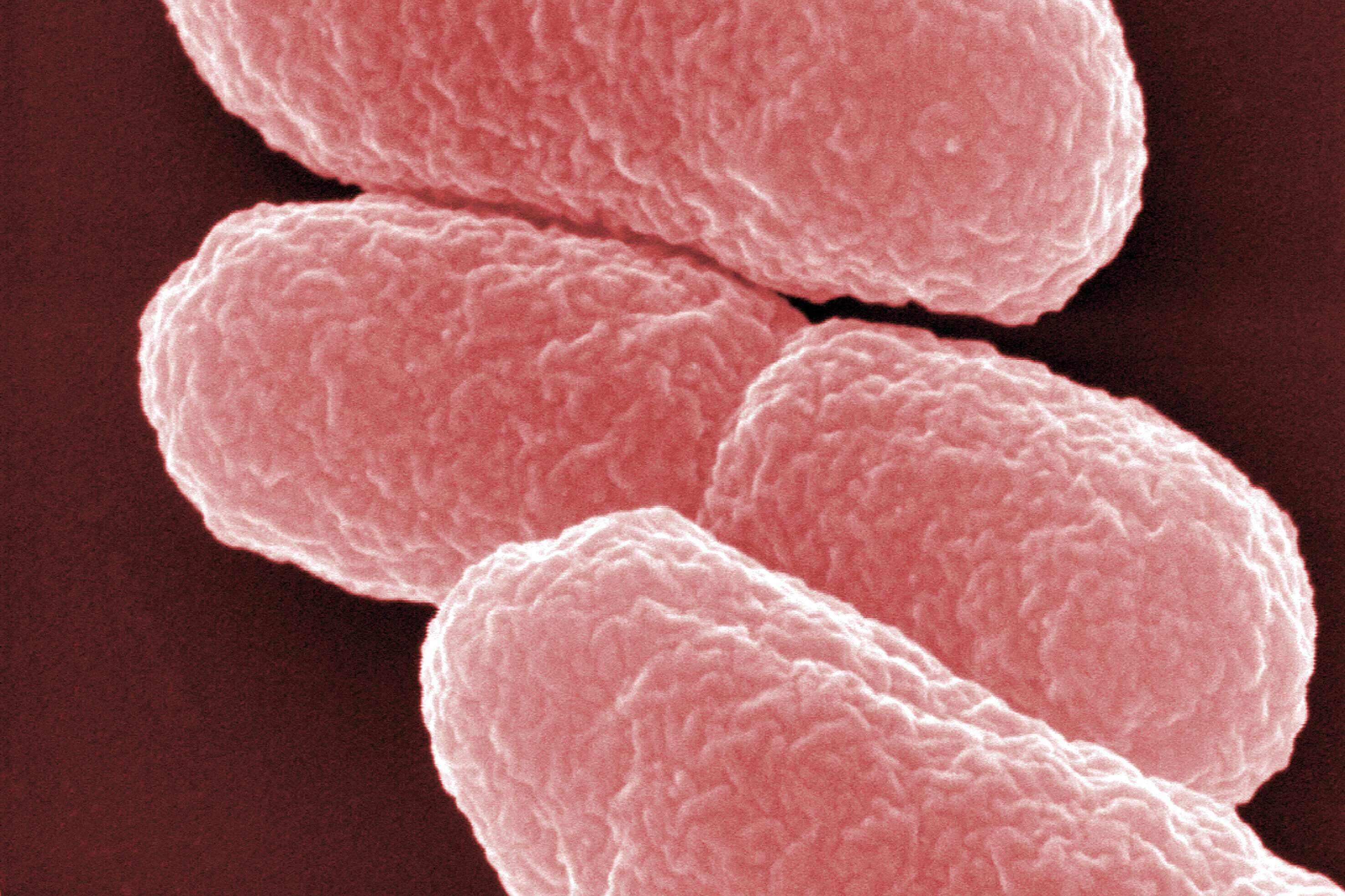 Darmbakterium Escherichia coli 