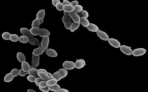 Langfristige Auswirkungen von Influenza-A-Virus-Infektionen auf Lungenzellen und deren Reaktion auf Pneumokokken