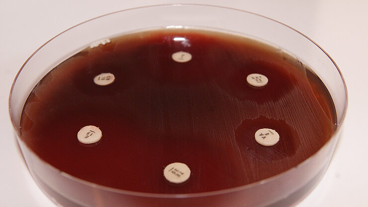 inhibition test in the laboratory