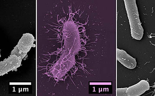 Rasterelektronenmikroskopische Aufnahmen der isolierten Prevotella-Spezies