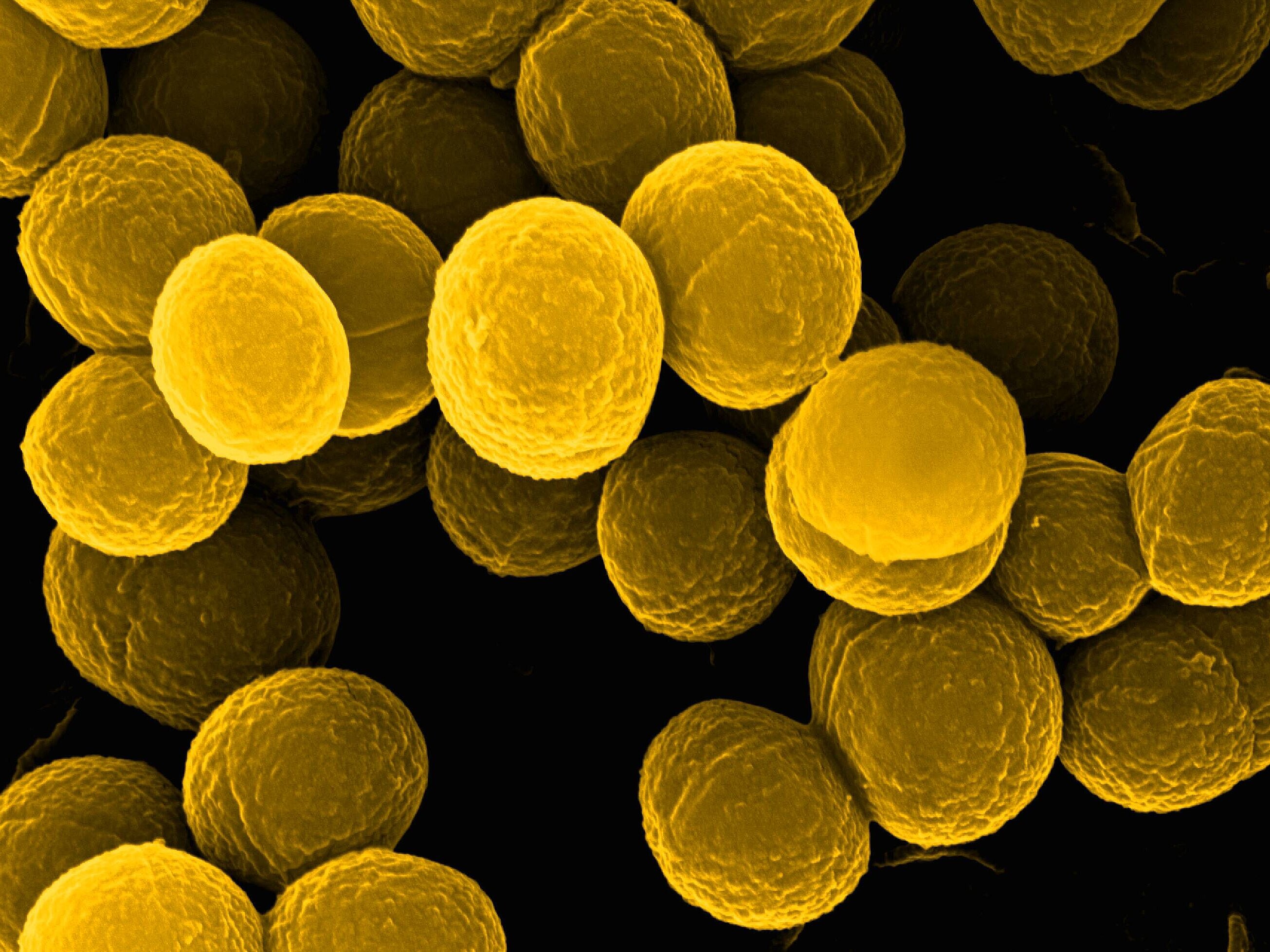 staphylococcus aureus