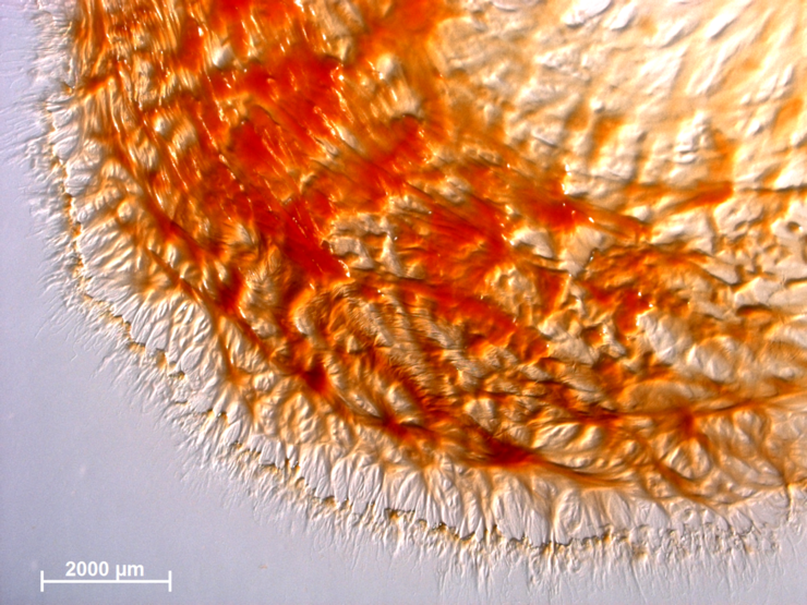 Mikroskopische Aufnahme vom Rand der ausschwärmenden Kolonie eines neuen Myxobakteriums