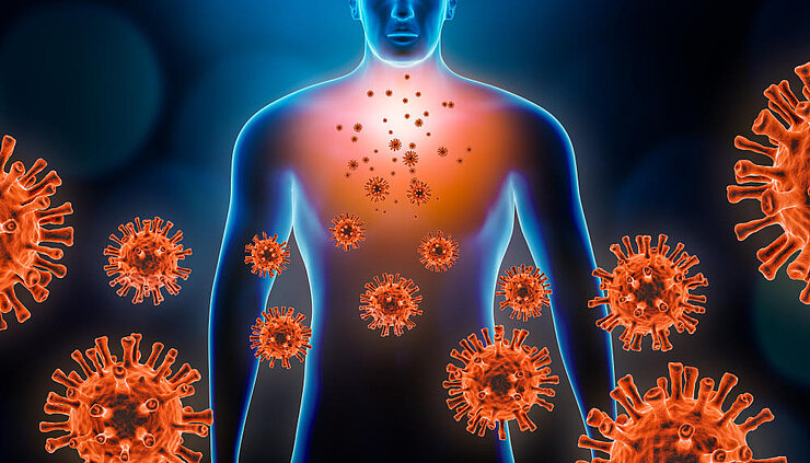 Symbolbild Lungenentzündung durch ein Virus