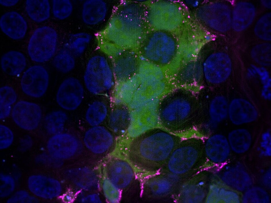 RSV-infected cell