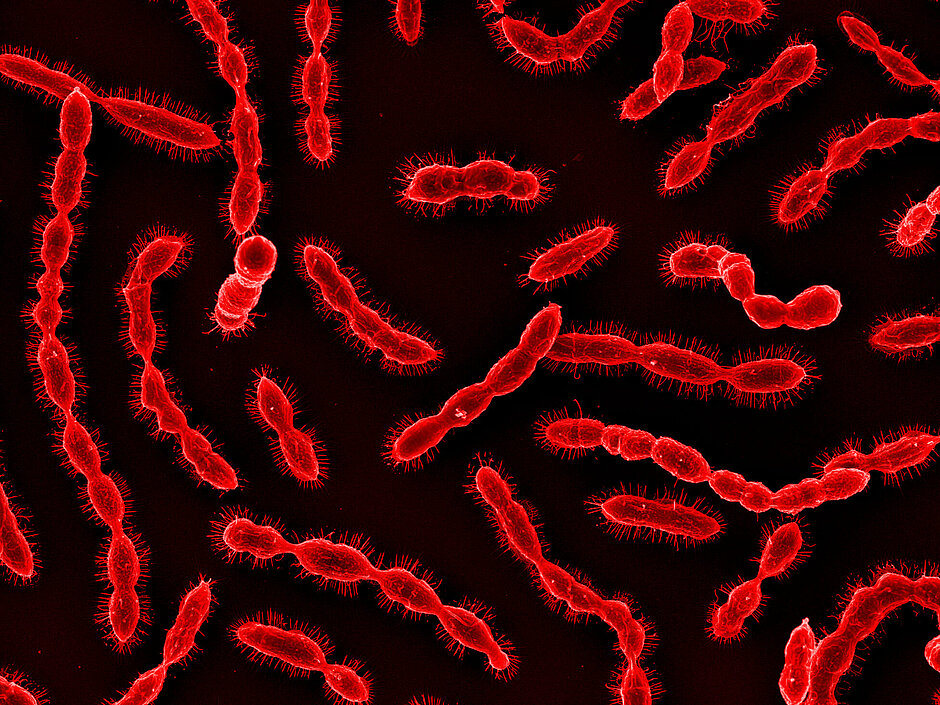 Elektronenmikroskopische Aufnahme von Streptococcus pneumoniae