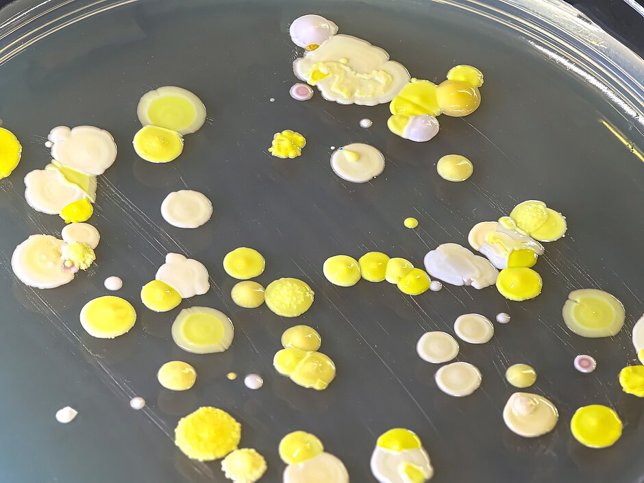 Various bacterial colonies in a petri dish