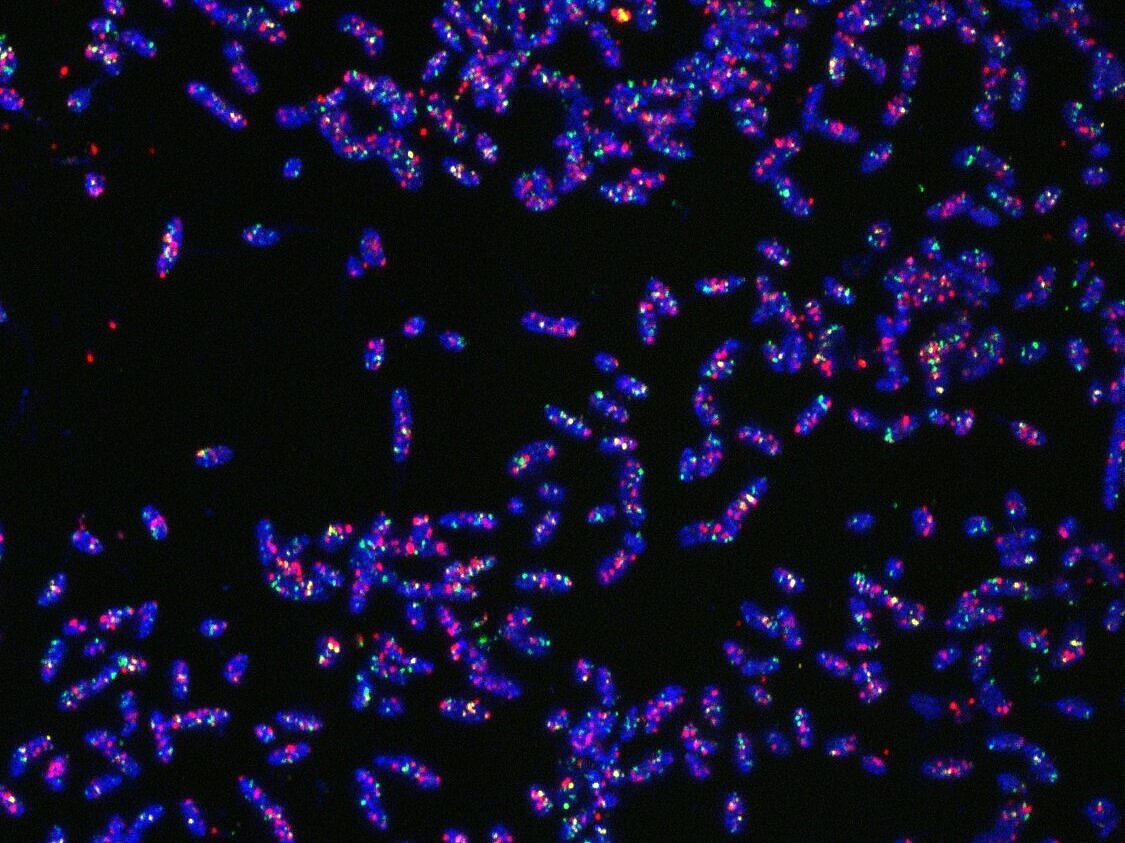 Gefärbte Zellen von Bacteroides thetaiotaomicron