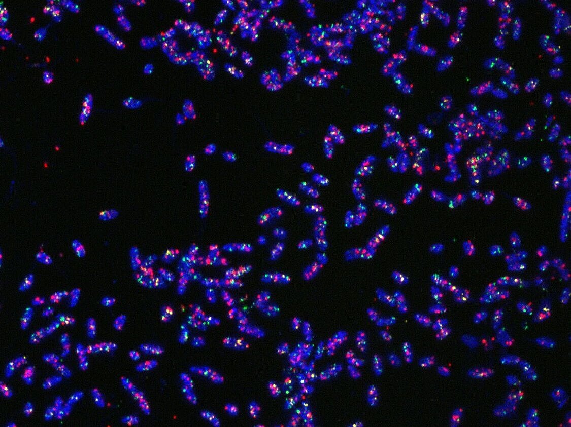 Stained cells of Bacteroides thetaiotaomicron