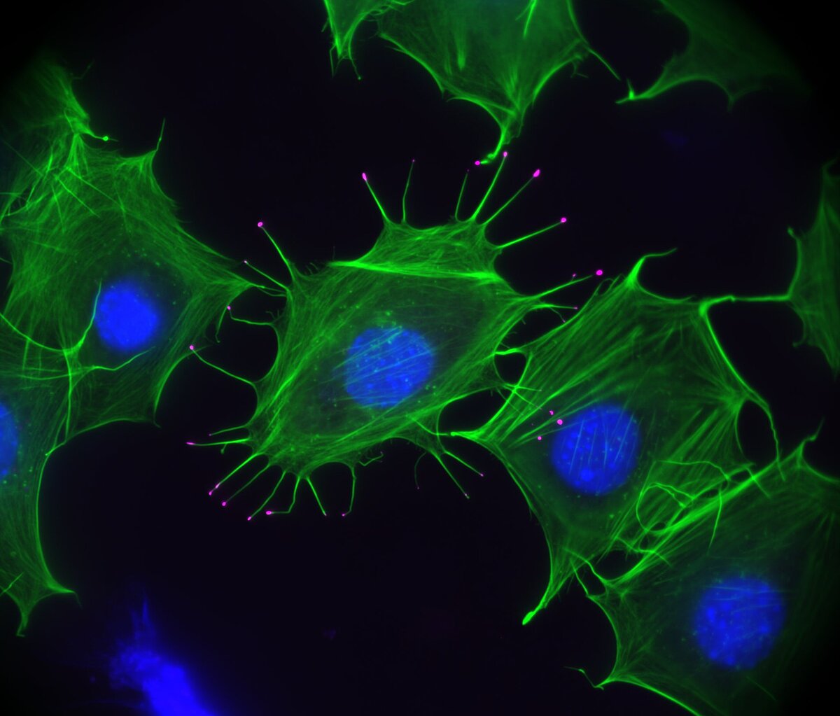 Fluoreszenzmikroskopie von Membran-Ausstülpungen einer Mauszelle. Das Aktin-Zellskelett ist grün, das Motorprotein Myosin X ist magenta und der Zellkern ist blau dargestellt.