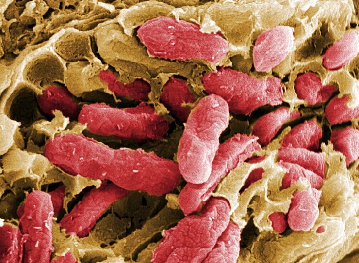 Electron microscope image of salmonella in the intestine