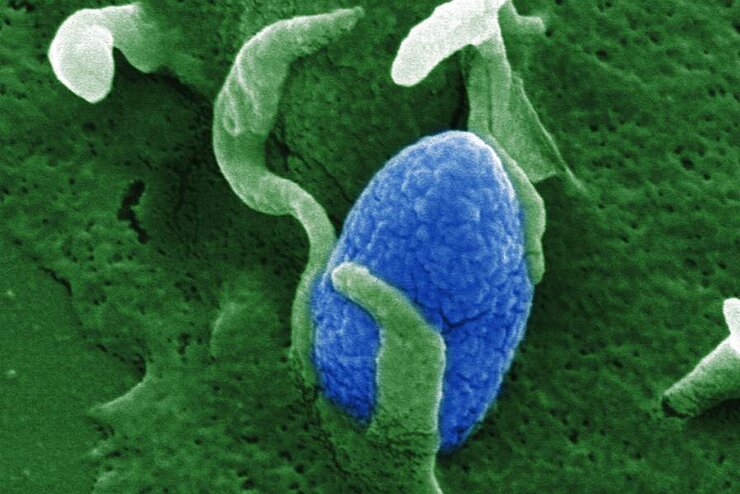 Invasion of bacteria in a cell