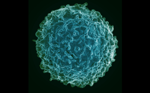 Rasterelektronenmikroskopische Aufnahme einer menschlichen B-Zelle