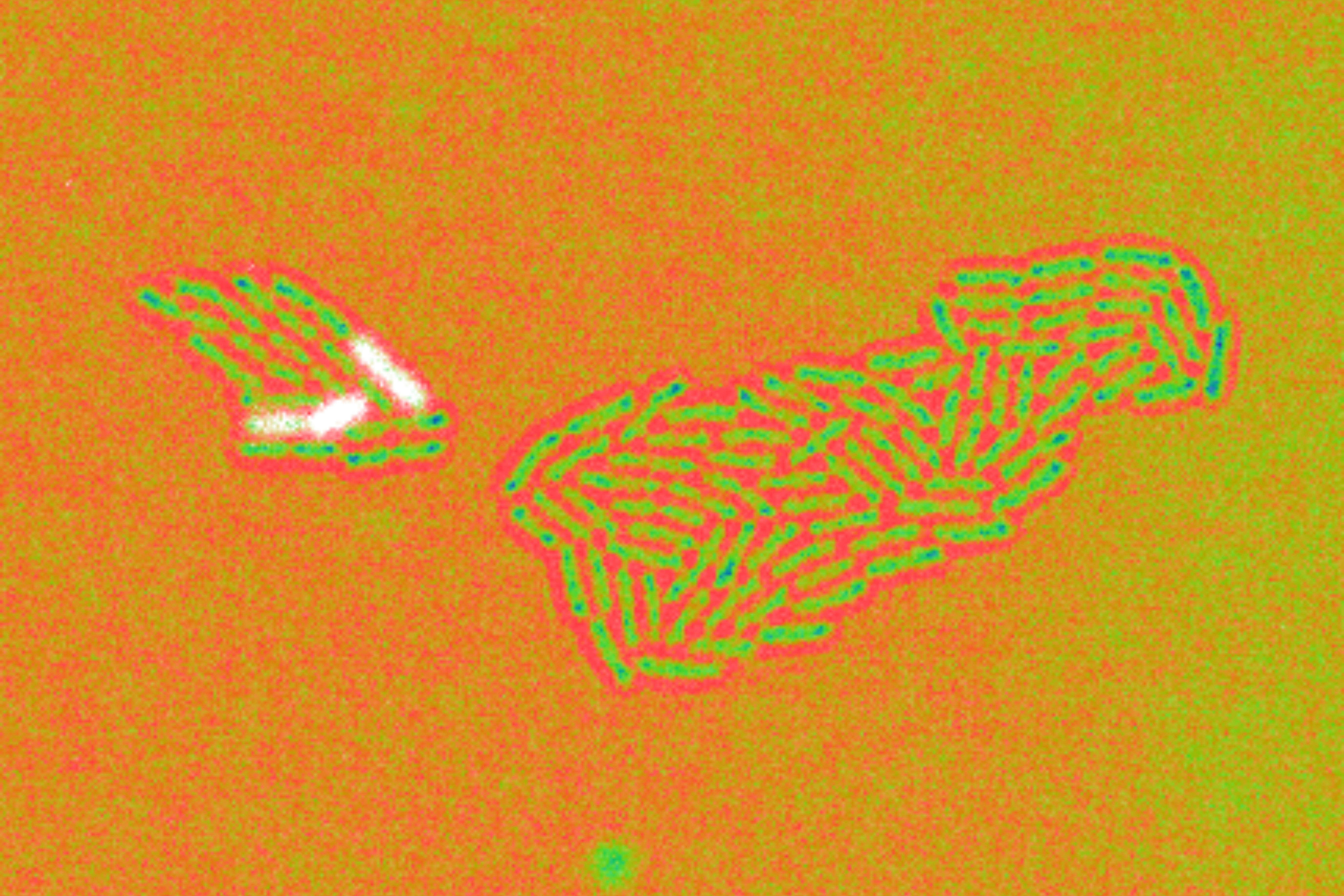 Pseudocolored cells of Pseudomonas aeruginosa