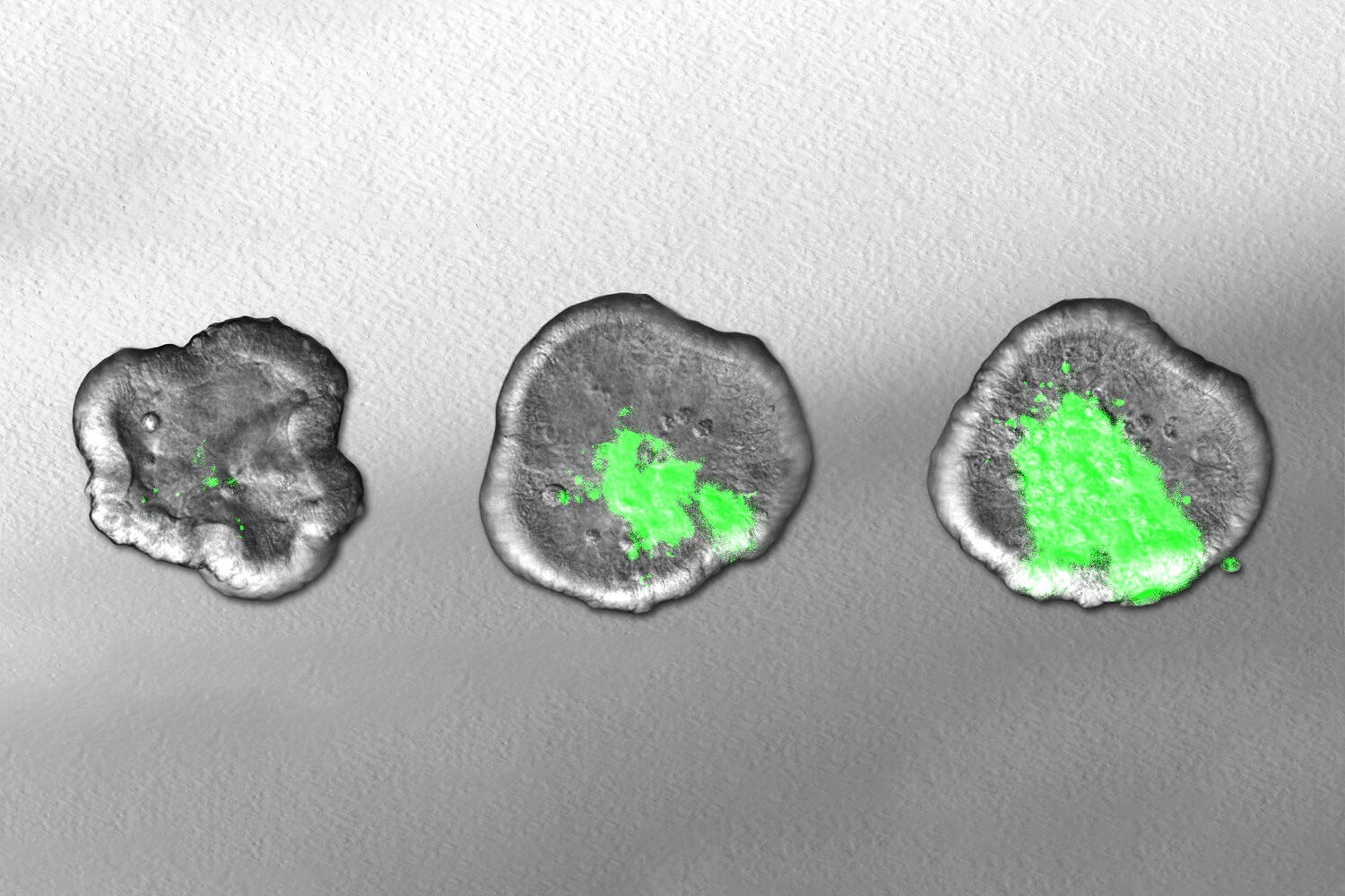 Three intestinal organoids (gray) with spreading Shigella infection (green)