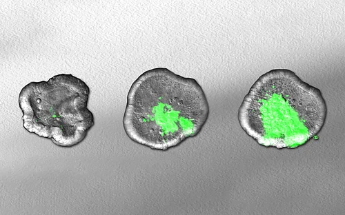 Cultured mini-organs reveal the weapons of aggressive bacteria