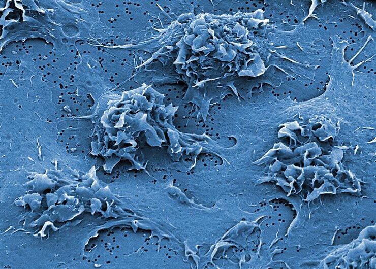 Electron micrograph of macrophages