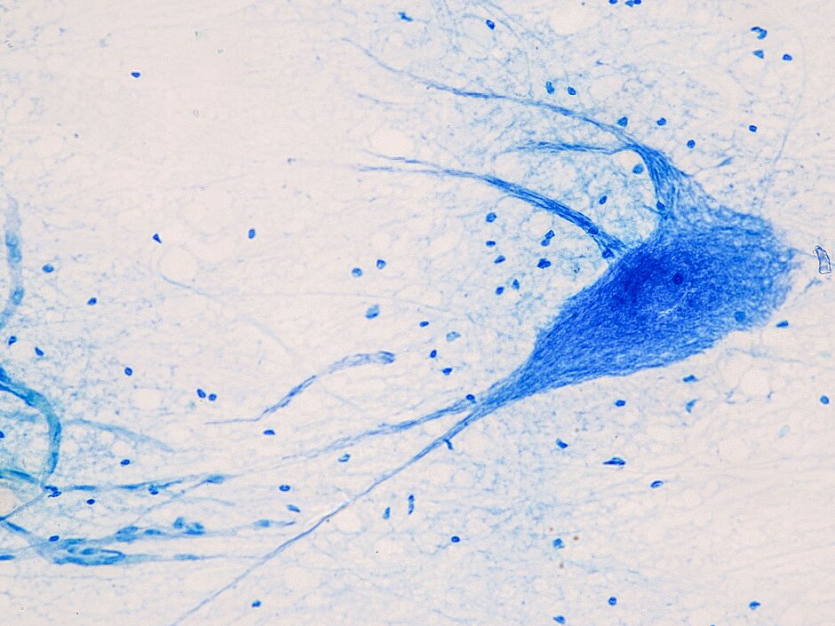 Rückenmark, Nerven, Kleinhirn, Hirnrinde und Motorneuron des Menschen unter dem Mikroskop im Labor