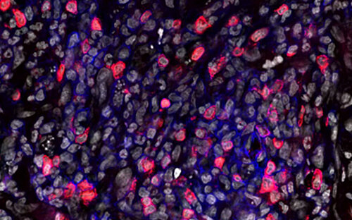 Mikroskopieaufnahme einer Infektionsstelle von Leishmania major in der Haut