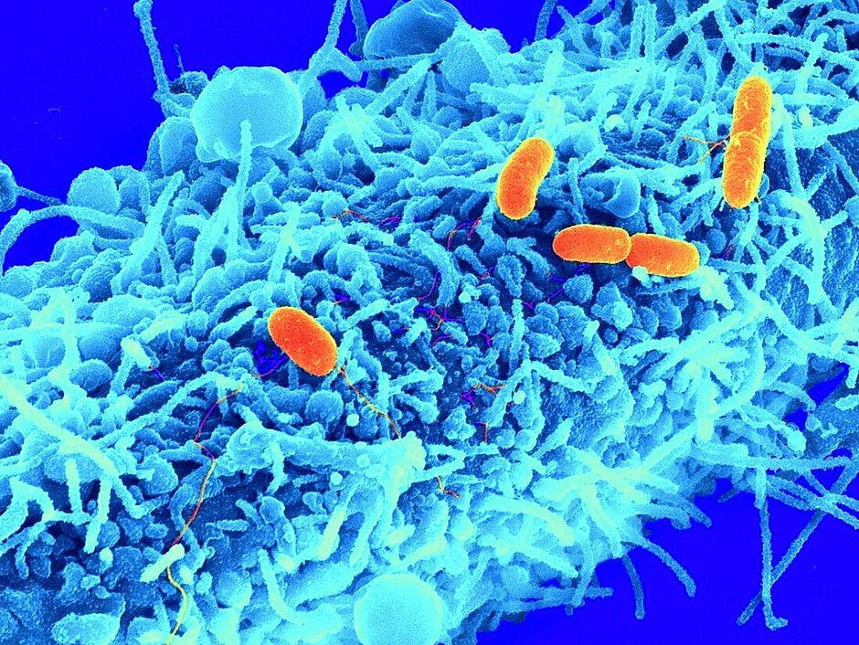 Bakterielle Infektion von Wirtszellen: Begeißelte Erreger des Typs Salmonella typhimurium (orange) nehmen Kontakt mit einer menschlichen Wirtszelle (blau) auf.