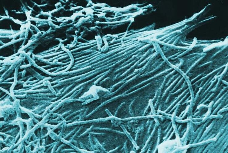 Electron microscope image of the Ebola virus