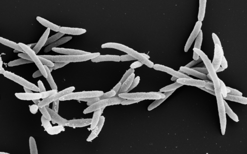 Elektronenmikroskopieaufnahme von Fusobakterien