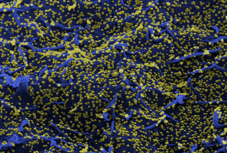 Rasterelektronenmikroskopische Aufnahme von MERS-Viruspartikeln (gelb) auf der Zelloberfläche