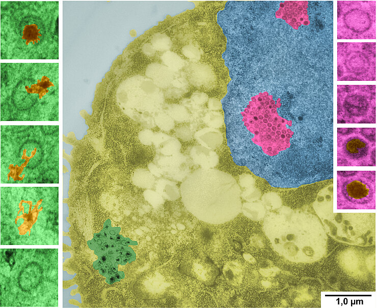 Microscopic image of herpes virus