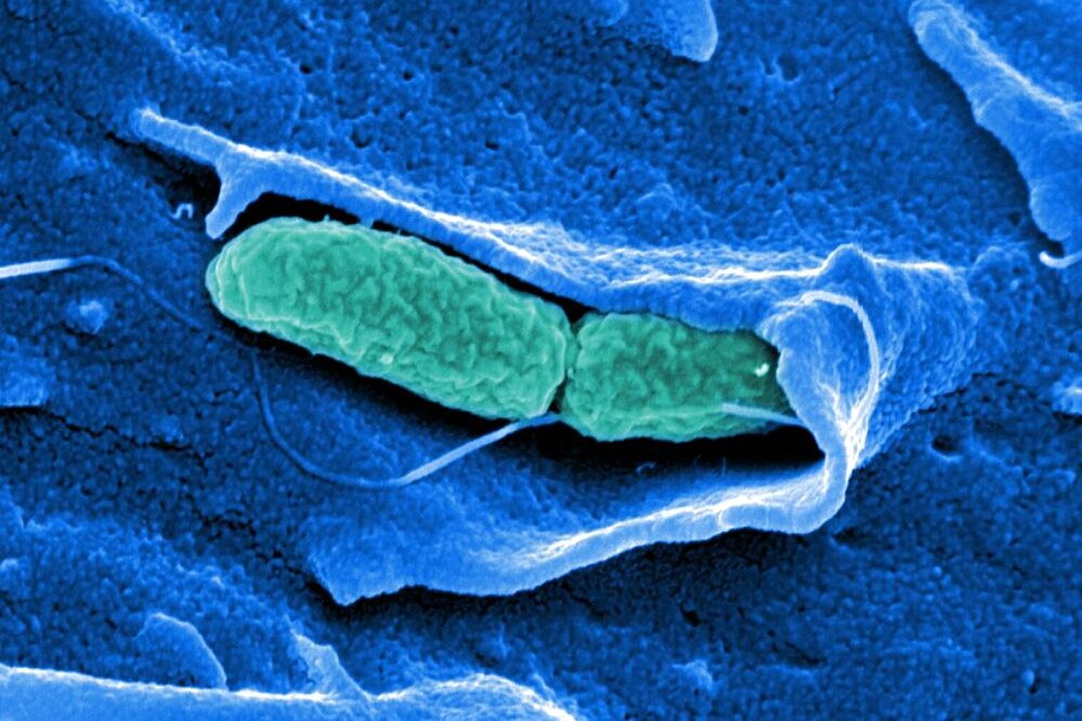Salmonella typhimurium on Cos 7 cell