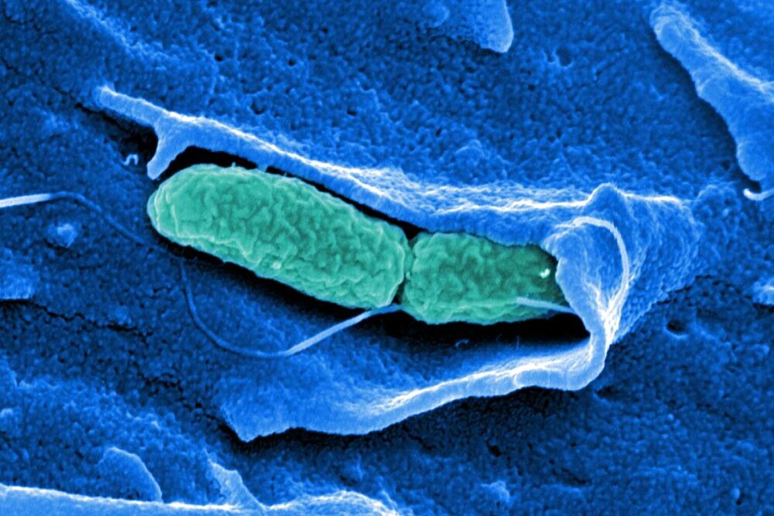 Salmonella typhimurium auf Cos 7-Zelle