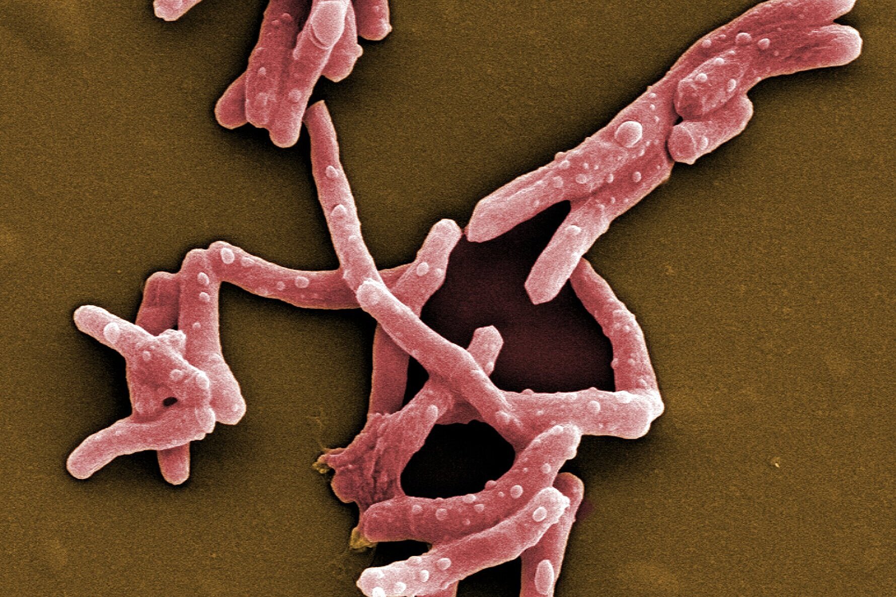 Scanning electron microscope image of Mycobacterium tuberculosis.