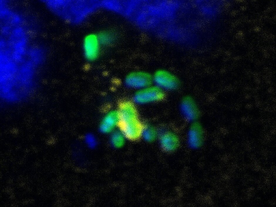 Visualization of host autophagy machinery targeting Salmonella: host cell nucleus and Salmonella shown in blue, with Salmonella highlighted in green and autophagy machinery surrounding the bacteria in yellow.