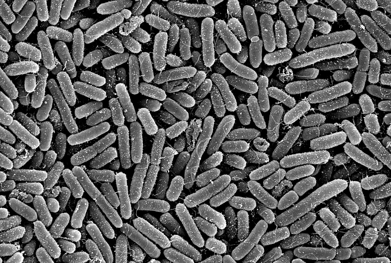 Elektronenmikroskopische Aufnahme von Pseudomonas aeruginosa 