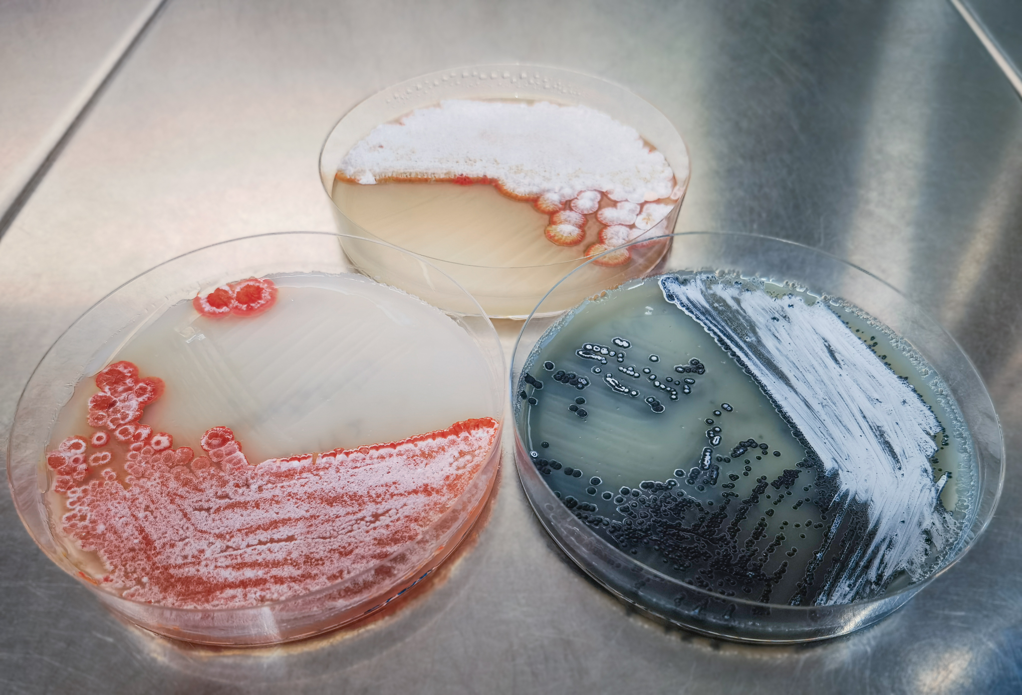 Kulturen unterschiedlicher Streptomyces-Stämme