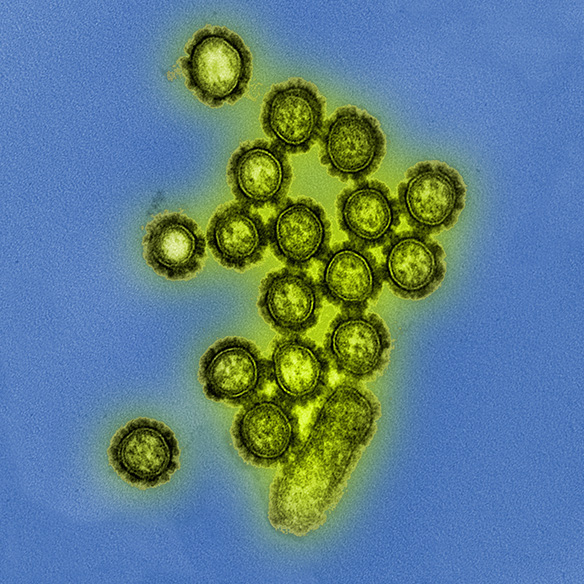 Elektronenmikroskopische Aufnahme von Viruspartikeln des Grippeerregers Influenza.