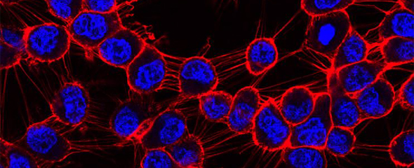Fluoreszenzmikroskopische Aufnahme von menschlichen Zellen. 